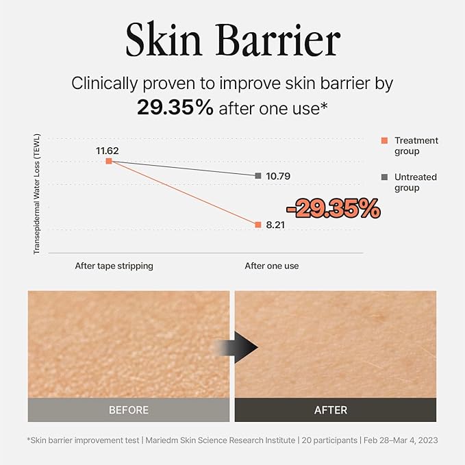 Silver Frost Mist - Facial Barrier Toner Spray with 80% Witch Hazel Water, Cica for Skin Barrier Repair, Recovery Mist for Sensitive Skin, Dewy Hydration, Korean Skin Care (3.38 fl oz)