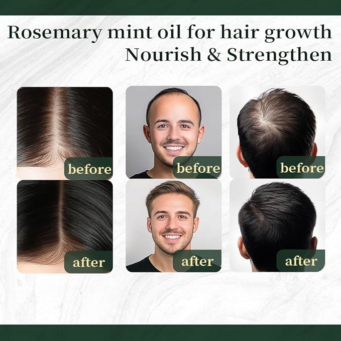 NP NATURES PHILOSOPHY Rosemary Mint Hair Growth Oil, Stimulates Hair Regrowth, Anti-Hair Loss, Nourishing Scalp Treatment for Thicker Fuller Hair, Aussie Hair Growth Products for All Hair Types