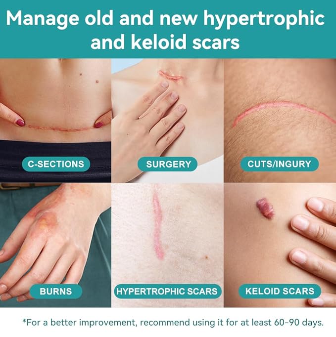 Dimora Professional Silicone Scar Sheets -