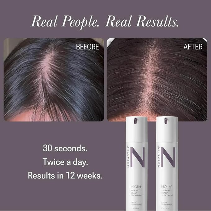 NULASTIN Hair Serum - HAIR Vibrant Scalp Treatment - Promote Scalp Care & Thicker Looking Volume in Thinning Hair - With Keratin & Peptides to Help Minimize Visible Shedding (2 Count, 1.7 Oz Each)