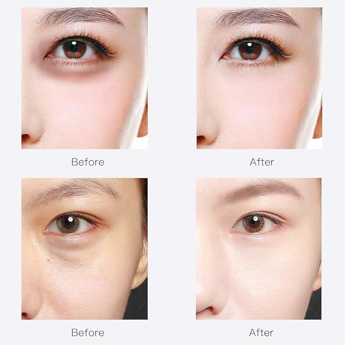 Under eye patches,30 pairs hyaluronic