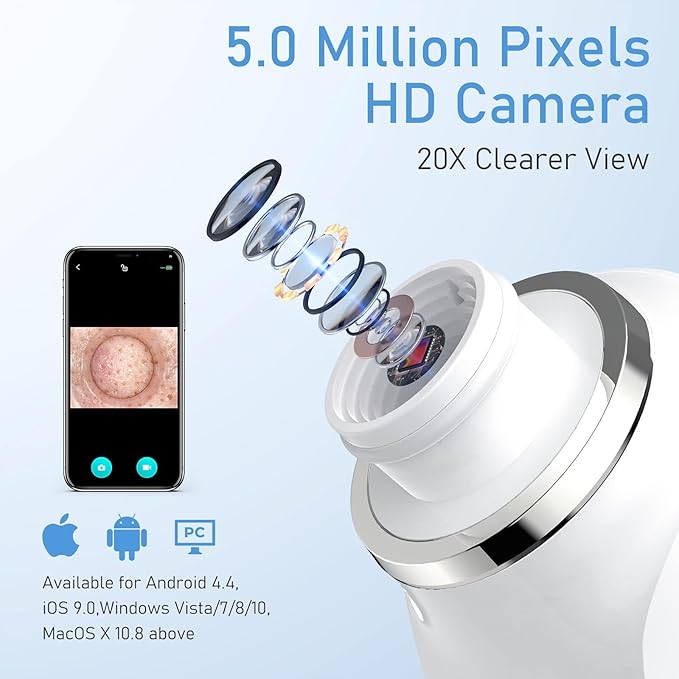 Facial Pore Blackhead Remover Vacuum, 1080P Camera Blackhead Remover, 20x Zoom, 8 LEDs ＆ 3 Suction Modes, 800mAh Battery & USB - 6 Heads Pore Cleaner Kit for Women&Men(Black)