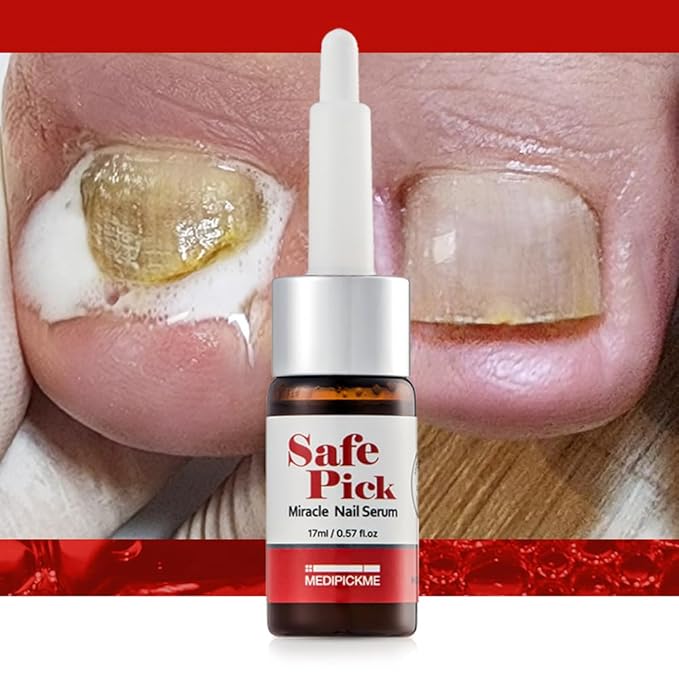 Safe Pick Miracle Nail Serum17ml