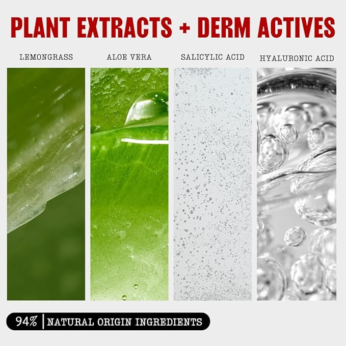 Thayers Blemish Clearing Salicylic Acid Toner, Acne Treatment Face Toner with 2% Salicylic Acid, Soothing and Non-Stripping Skin Care, 12 Fl Oz