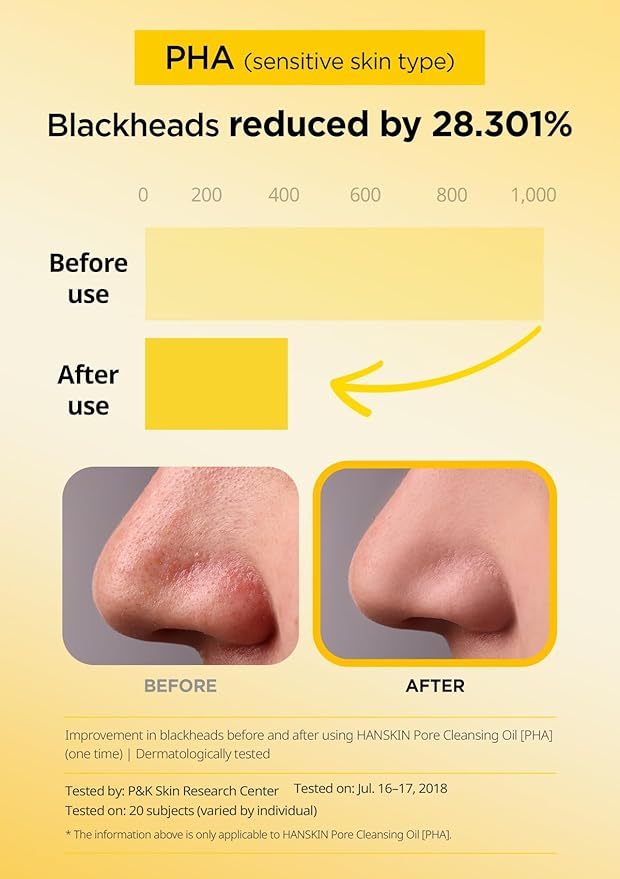 Hanskin Pore Cleansing Oil, Oil Cleanser for Face, Makeup Blackhead Sebum Remover, Korean Deep Pore Cleanser for Sensitive Skin [PHA] (10.14 oz)