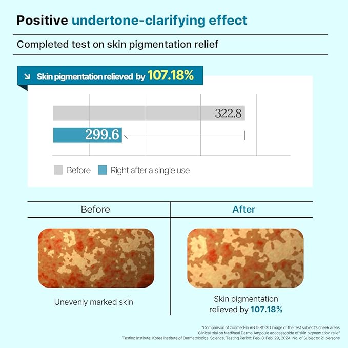 Mediheal Derma Modeling Pack (Madecassoside) - Relieving Blemish Marks For Clear Skin - Easy DIY Home Spa Kits, Hydrating Icy Jelly Mask For Skin Refreshment