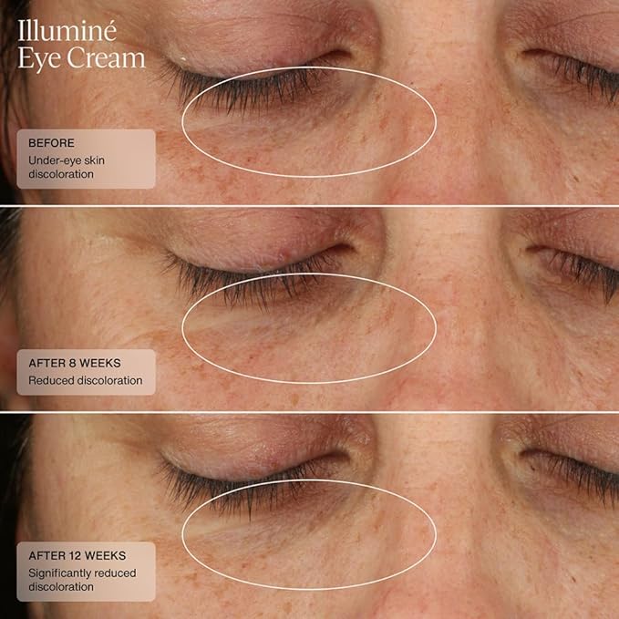 Senté Illuminé Eye Cream | Diminish Dark Circles, Discoloration, Redness, and Puffiness Around The Eyes | with Patented HSA, Niacinamide and Peptides | 0.5 Oz