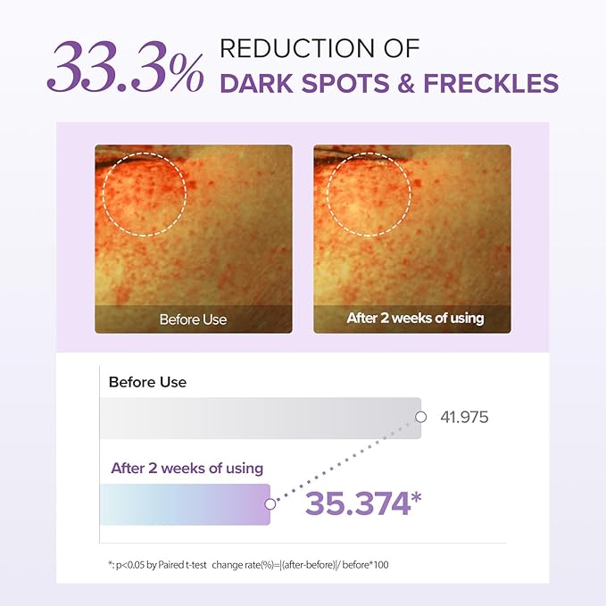 Mary&May Tranexamic Acid (TXA)+Glutathione Eye Cream | Dark Circles & Hyperpigmentation | With Niacinamide & Vitamin C | Firms Under Eye Area | Wrinkle & Fine Line Care | Korean Skincare, 1.01 oz.