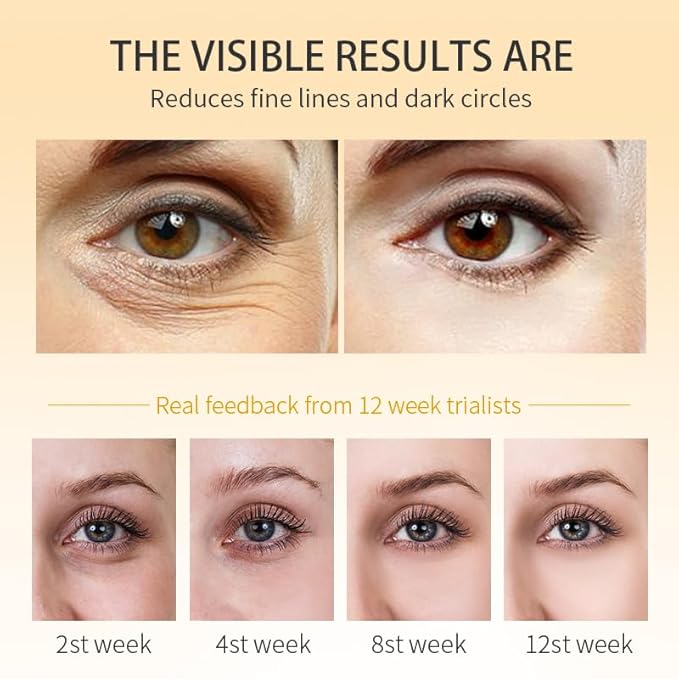 RtopR Mango Firming Eye Cream, Under Eye Cream for Dark Circles and Puffiness, Firm and Smooth the Look of Fine Lines, Smoothes the Skin Around the Eyes