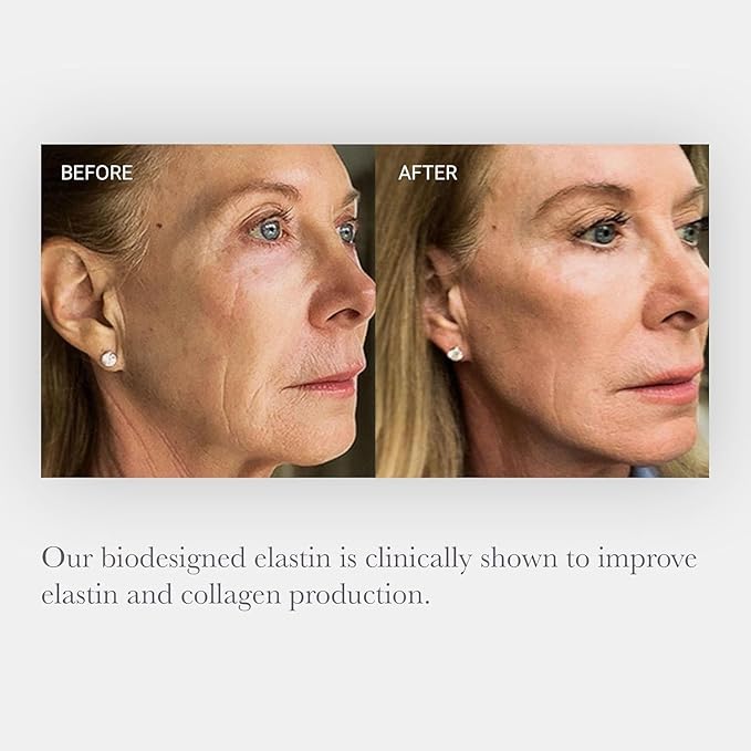 NULASTIN Elastaplex & Hyaluronic Acid Serum for Face, Lips & Décolleté - SKIN Intensive Hydrating Serum - Promote Dewy Radiance in Aging Skin (0.5 oz)