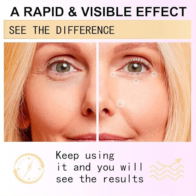 Snail Peptide Eye Cream, Snail Mucin Eye Cream Contains Niacinamide, Hyaluronic Acid To Reduce Wrinkles, Dark Circles, Puffiness and Fine Lines 17 ML