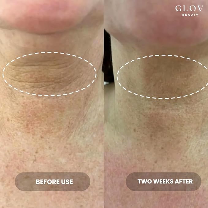 Glov Beauty - Lift & Firm Neck Cream - Anti-Aging Neck & Décolleté Cream for Wrinkles, Sagging Skin & Tightening - With Shea Butter, Niacinamide & Hyaluronic Acid - All Skin Types