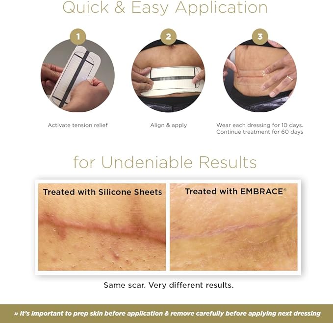 Embrace Active Scar Defense for New Tummy Tuck Scars, FDA-Cleared Extra-Large Silicone Scar Sheets, 30 Day Supply