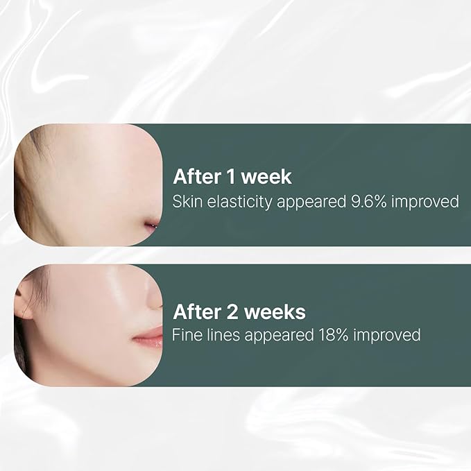 shaishaishai LIPOSOME REPAIR MILKY Cream, 72HR Intensive Hydration, Skin Barrier Repair with Urea 6%, Face Moisturizer, Collagen Boost, Korean Skincare, 1.69 fl oz