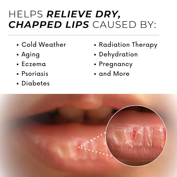 Natural Lip Balm For Very Dry Lips,