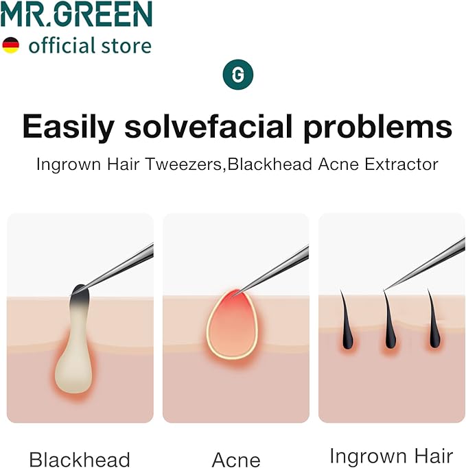 MR.GREEN Ingrown Hair Tweezers Needle Nose Pointed Tips Tweezers For Eyebrows Splinters Blackhead Removal Acne Clip Extractor (Long)