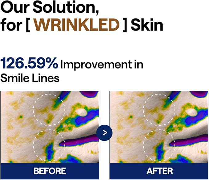 MEDIHEAL Retinol Collagen Lifting Pad - Vegan Face Hypoallergenic Pads with Retinol, Collagen - Lifting Pads for Enhancing Skin Texture Firmness 100 Pads