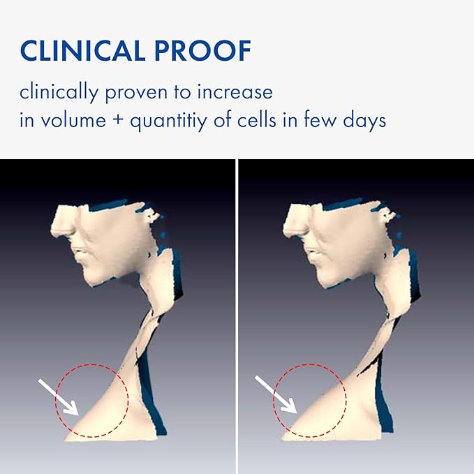 TOSOWOONG Volufiline Serum, 100% France Sederma Volufiline Concentrate for Plumping, Skin firming, Boost and Glass skin, glow Skincare for Face, lip and body, 11ml 0.37 fl. oz.