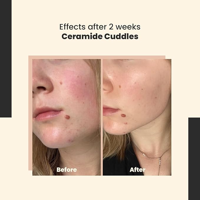 Ceramide Cuddles - Regenerating Ceramide Serum for Barrier Repair and Hydration – Calming and Redness-Reducing – All Skin Types – 30 ml/Net 1.01 Fl. Oz