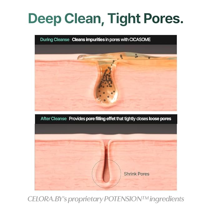 CELORABY Pore Recovery Bundle – 5-in-1 Glass Skin Device + Exosome Pore Serum for Deep Pore Care, Sebum Control, Enhanced Absorption, Korean Skincare at Home