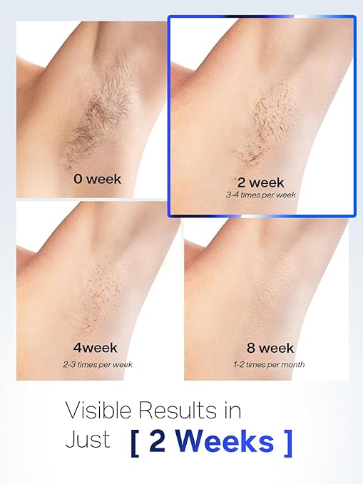 Blex Laser Hair Removal for Women and Men, IPL Hair Removal Device Effective in 2 Weeks, with Ultra-Fast 0.2s Light Emission, Comfortable and Painless, Sky Blue