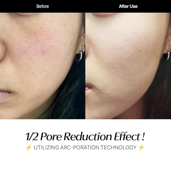 CELORABY Potension Penta-Shot Glass Skin Glow Booster | 5-in-1 Korean Face Device for Pore Minimizing, Black Head Care, Pore Strips Nose, Enhanced Absorption & Needle-Free Treatment at Home