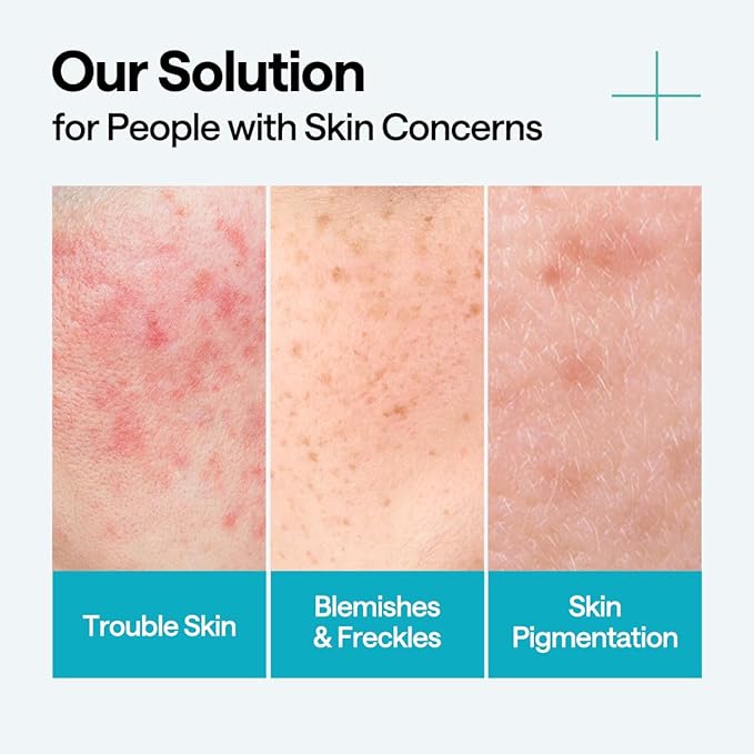 Mediheal Madecassoside Repair Serum 1.35 fl.oz - Blemish Care, Fades Pigmentation & Skin Soothing & Hydration - with Centella Asiatica, Niacinamide