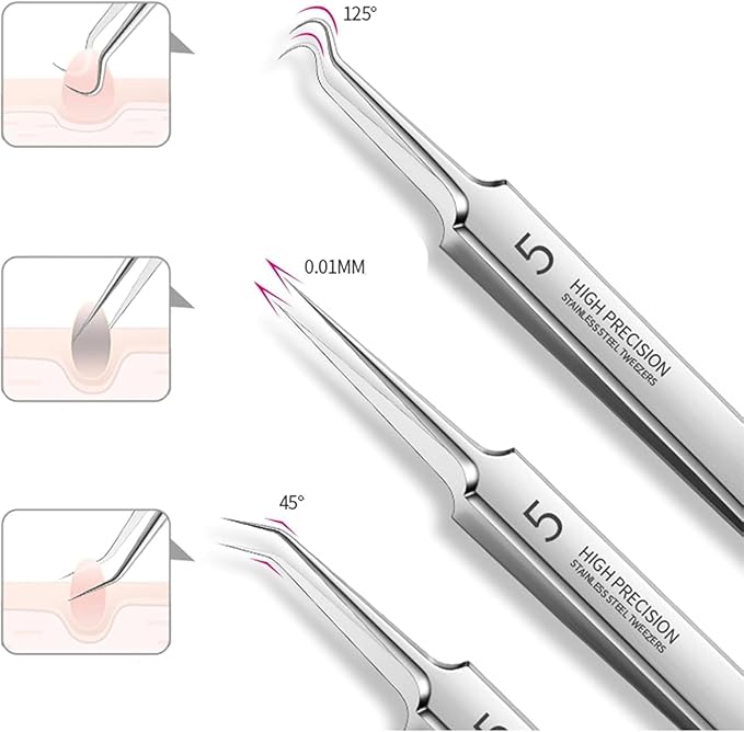 10 Pcs Acssart Blackhead Remover Tools, Acssart Stainless Steel Blackhead Remover Kit, Pimple Popper Tool Kit, Blackhead Tweezers with 15x Magnifying Glass, Metal Case