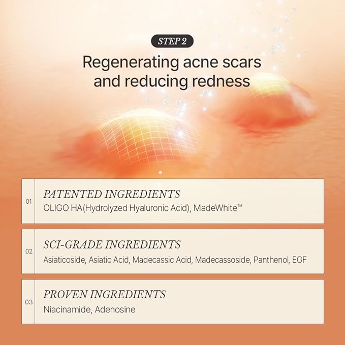 [CHALLANS de PARIS] Ampoule d’Aurora Excellence – Soothing & Balancing Skin-Barrier Support Serum with Niacinamide, Oligo-HA & Ceramide | Lightweight Watery, Hydrating Korean Skincare, 1.23 fl oz