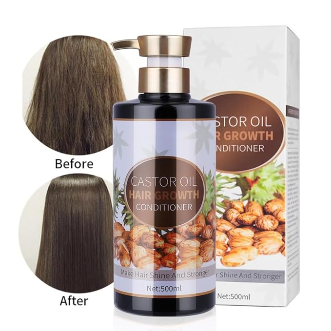 Silvercell Castor Oil for Hair Growth Conditioner, Prevents Hair Loss Conditioner Strengthens Hair Roots, Hair Care Conditioner Nourishes Dry Hair, Hair Thickening for Women & Men,16.91 fl.oz