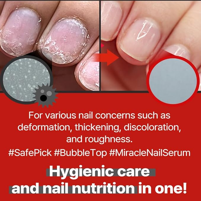 Safe Pick Miracle Nail Serum17ml