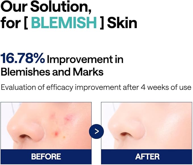 MEDIHEAL Toner Pads [Madecassoside] - Blemish Care Toner Pad with Centella Asiatica - Improves Uneven Skin Tone & Deep Hydration - Vegan Hypoallergenic Face Gauze (100 Count)