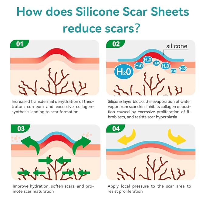 Dimora Professional Silicone Scar Sheets -