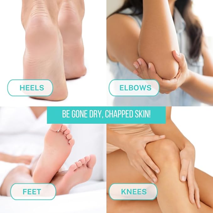 Onyx Professional Cracked Heel Repair Balm Stick, Tea Tree Eucalyptus Scent, 2 Pack - Dry Heels Dry Cracked Feet Treatment, Moisturizing Heel Balm Rolls On, No Mess Like Foot Cream or Foot Lotion