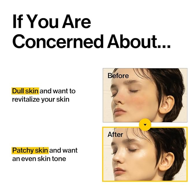 d'alba Piedmont White Truffle Oil Capsule Serum, Daily Vita Boost for Luminous Skin, Double Vitamin Formula, Big Size (3.38fl. oz.)