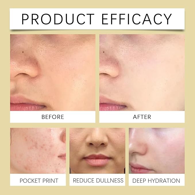 Toner for Face, Hydrating Face Toner with Propolis Extract & Hyaluronic Acid, Nourishing & Soothing, Skin Care for Radiant Glass Skin, 3.38 Fl. Oz