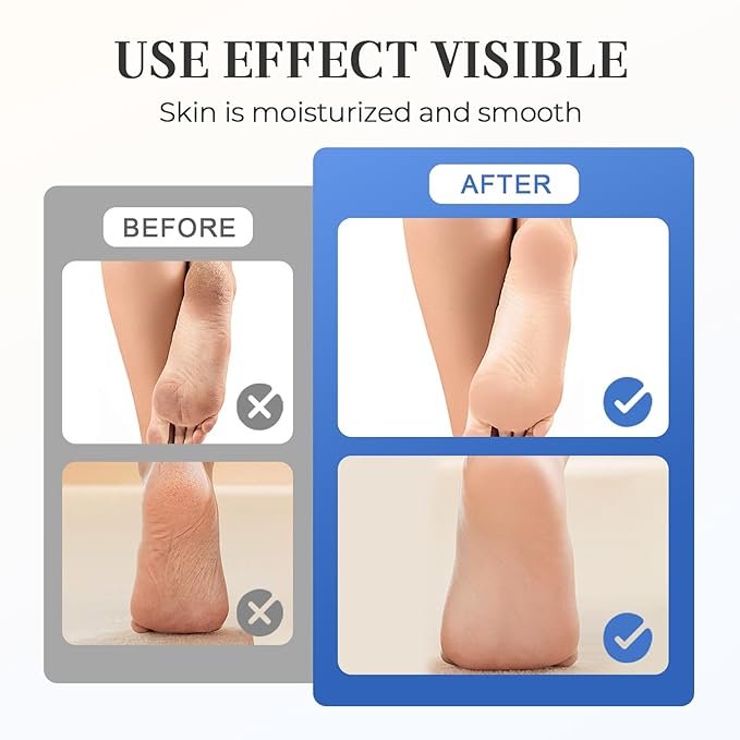 Hydrating and Anti-Cracking Foot Cream, 2025 Moisturising and Relieves Cracking and Dryness Foot Cream, Hand and Foot Repair Cream for Women & Men Callused, Feet, Knee, Elbow, Hand (White-3PCS, #01)