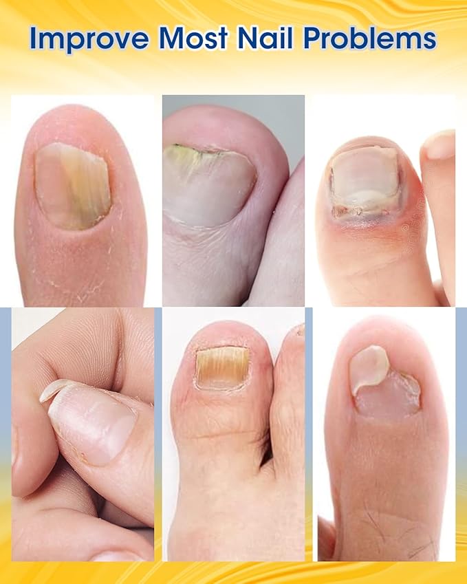 Nail Repair Patches Extra Strength,