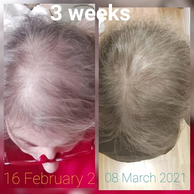 CRISAN 16oz Extreme Hair Growth and Strengthening Oil for Men and Women (16 fl oz)