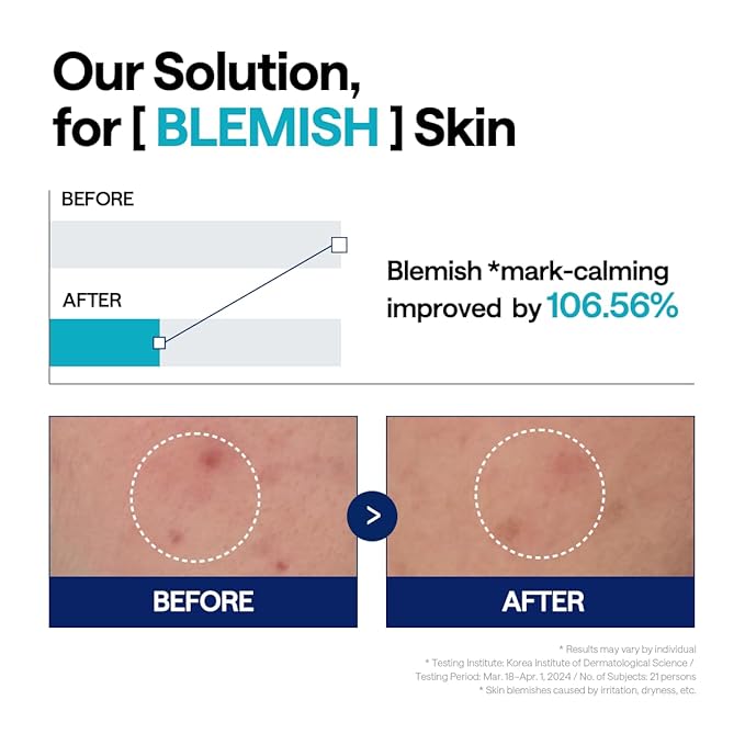 Mediheal Madecassoside Repair Serum 1.35 fl.oz - Blemish Care, Fades Pigmentation & Skin Soothing & Hydration - with Centella Asiatica, Niacinamide