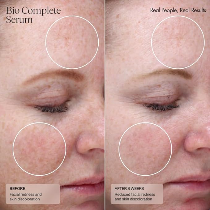 Senté Bio Complete Serum | Retinoid Serum for Sensitive Skin | Gentle, Nourishing & ﻿Hydrating | Combats Dull and Aging Skin | 1.0 Fl Oz