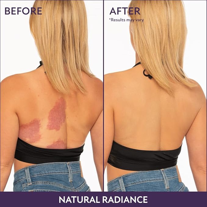 Westmore Beauty Body Coverage Perfector – Waterproof Leg & Body Makeup - Tattoo Cover Up Makeup - 7 Oz (Fair Radiance)