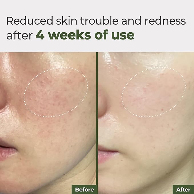 Daily Ampoule Pad – Centella Asiatica Infused Toner Sheets with Antioxidant Deep Nourishing Plant Extracts and Separate Ampoule Pouch for Skin Radiance – (100 Pads)