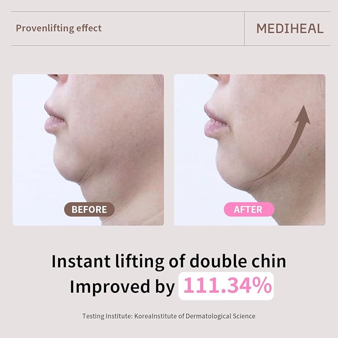 Mediheal Retinol Collagen Ampoule Lifting Mask (10 Counts) forV Line Mask, Anti-Aging - Helps Reduce Fine Lines & Wrinkles, and Smoothens Skin