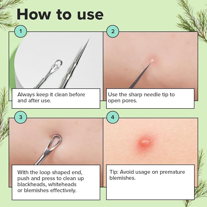 I DEW CARE Dual-Tip Pimple Tool - Proper Popper | Blackhead Remover, Blemish Exfoliating, Professional Acne Squeezer, Comedone Zit Extractor for Women, 2in1 Stainless Steel Lancet, 1ea