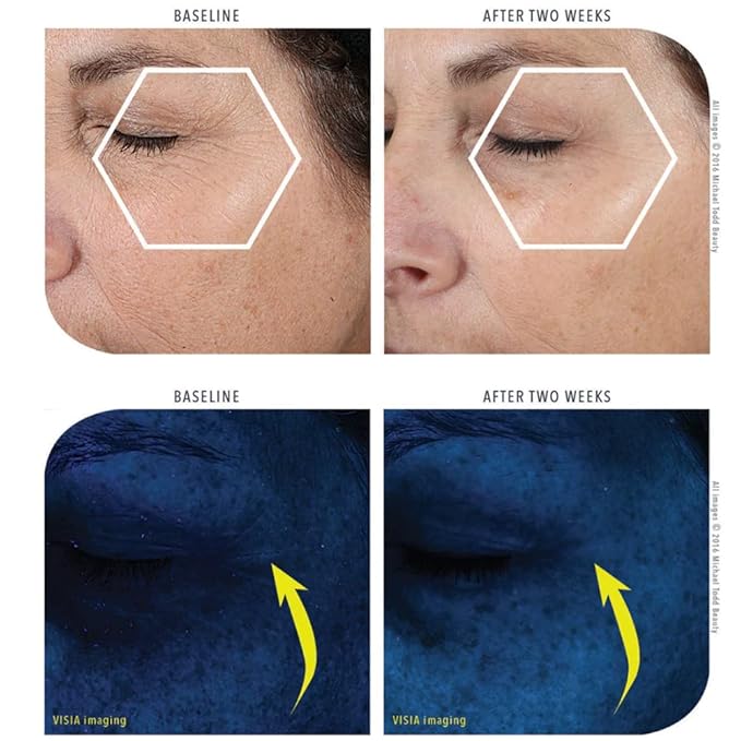 Michael Todd Beauty KNU Serum – Face Lifting, Brightening & Tightening Serum – For Restoring & Rejuvenating – With Aloe Vera, SSF, Peptides & Botanical Extracts – For All Skin Types – 1.01 fl oz/30 mL