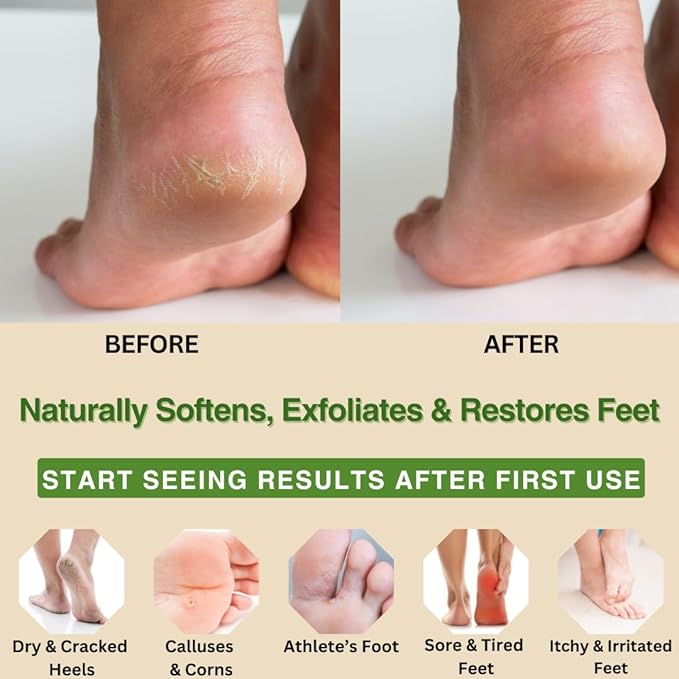 Natural Escapes Peppermint, Rosemary, Eucalyptus & Tea Tree Oil Foot Cream for Dry Feet, Cracked Heels, Calluses, Athlete's Foot - Heel Repair Cream for Women & Men (8 oz)