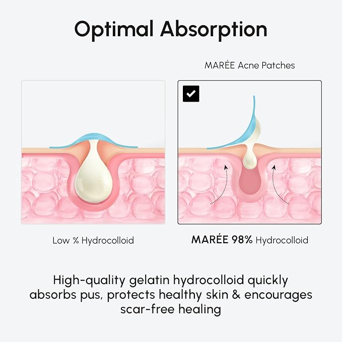 MAREE Invisible Pimple Patches 2 PACK - Clear Pimple Patches for Face - Hydrocolloid Acne Patches Anti Blemish - Zit Stickers for Face - Parches Para Acne - Pinple Zit Pimple Stickers - 144 Dots