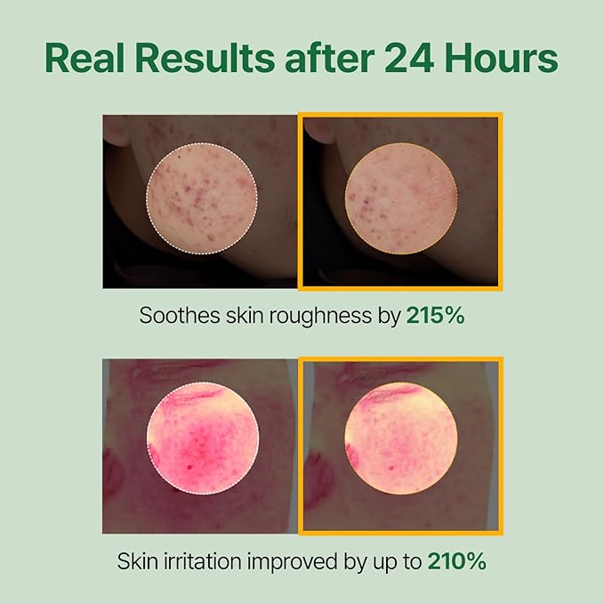 Mugwort Super Calming Toner - Korean Hydrating Toner for face, Purifying Mugwort Essence, Soothing, Calming, Refreshing Facial Toner for Oily, Dry, and Sensitive Skin, Daily Skin Care, 8.45 fl.oz