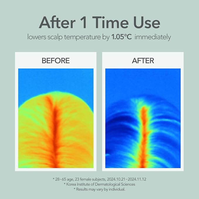 107 SCALP COOLING Breeze Shampoo - Soothing & Refreshing scalp cooling shampoo with 3-Year Aged Fermented Mugwort Vinegar – Scalp Care, Sebum Control (12.84 oz)